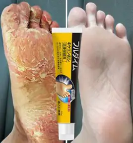 BT 손발톱 무좀치료제 진균 리페어에센스 케어제 발톱연화 무좀 관리, 30ml, 1개