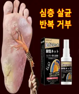 BT 발톱무좀 연고 무좀약 연고 발냄새 제거 발각질제거 연고, 2개, 20g